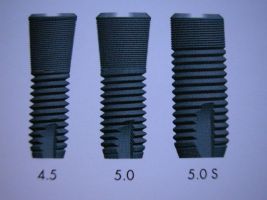 Implants with different diameters
